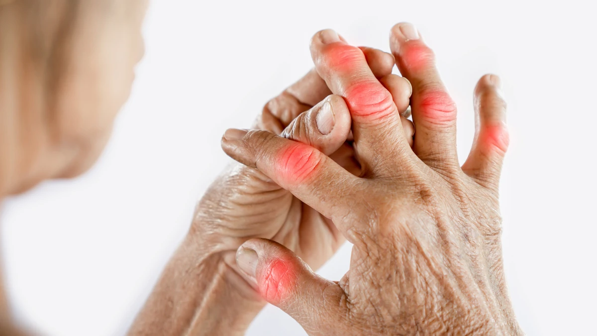 Cryotherapy for Arthritis Pain: A Complete Toronto Treatment Guide